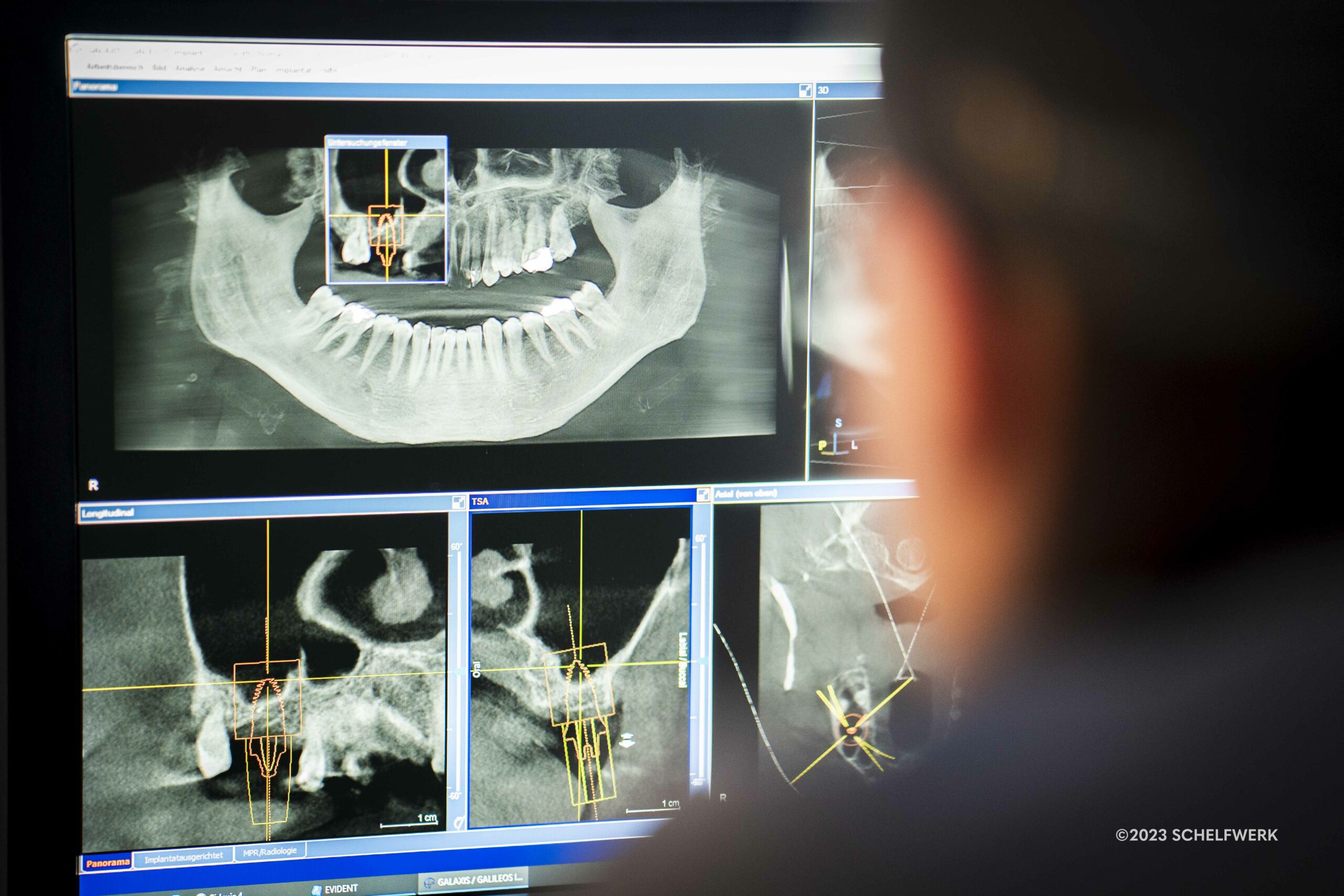 Auswertung eines 3D-Röntgen-Foto in der Boddenchirurgie Jesko Weden Ribnitz-Damgarten, Kieferchirurg analysiert Röntgen-Ergebnisse